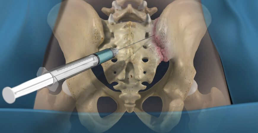 SI-Joint-Injection-img