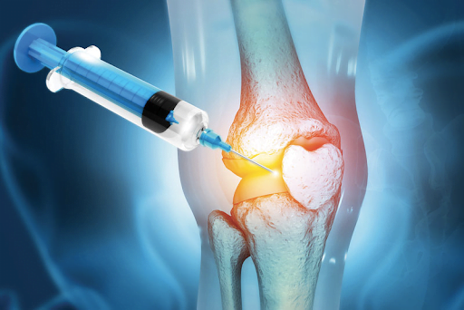 Knee Joint Injections