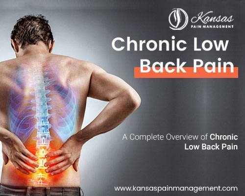 A Complete Overview of Chronic Low Back Pain