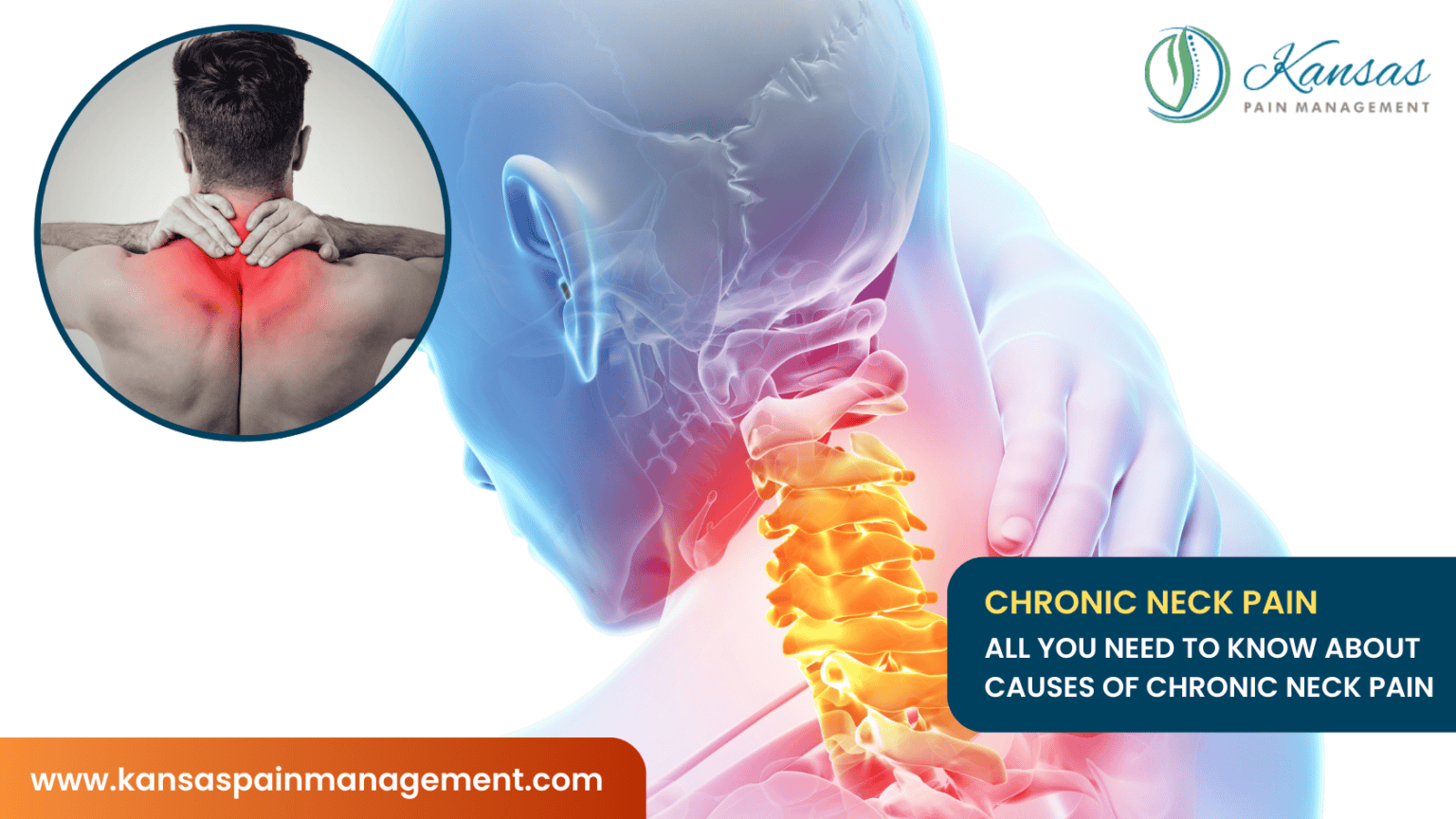 All You Need to Know About Causes of Chronic Neck Pain