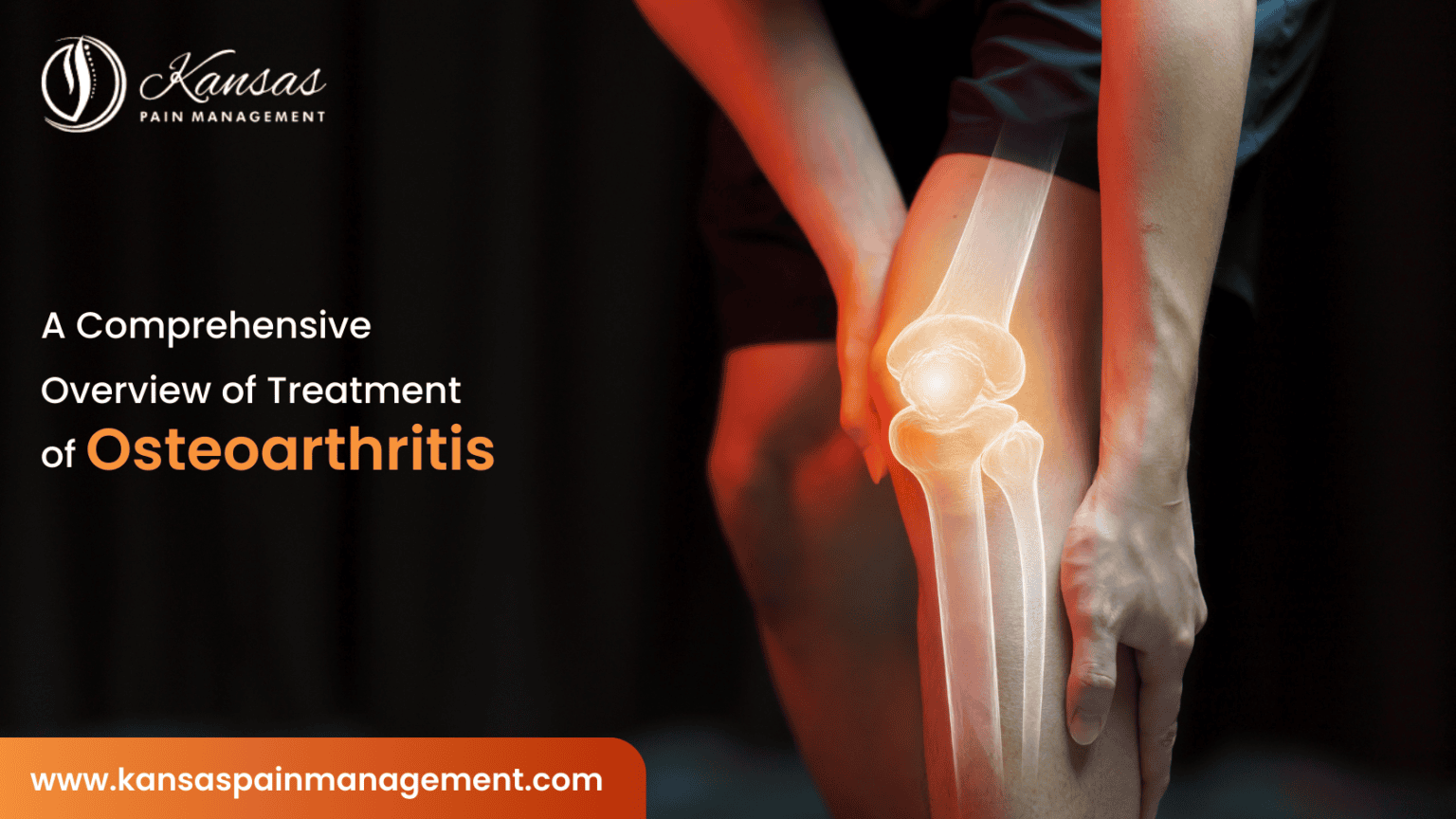 Treating Oa A Comprehensive Overview of Treatment of Osteoarthritis