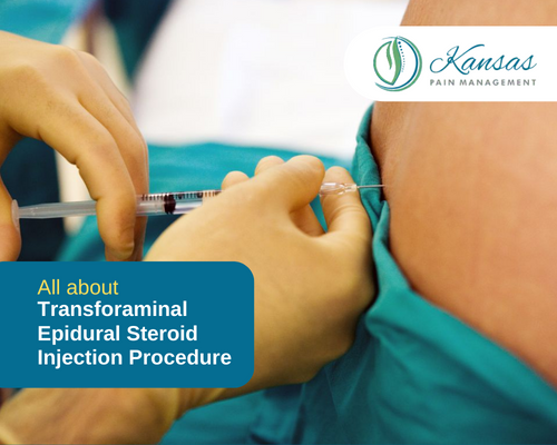 Transforaminal Epidural Steroid Injection Procedure, Side Effects & Recovery – The Complete Guide