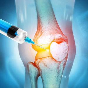Knee-Joint-Injections