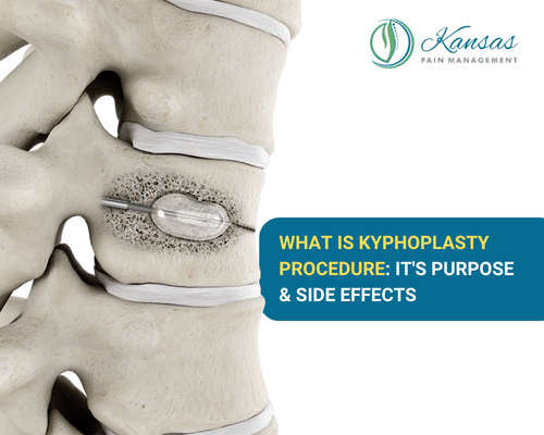 Kyphoplasty Procedure: It's Purpose & Side Effects