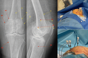 Treatment | Kansas Pain Management | Kansas City