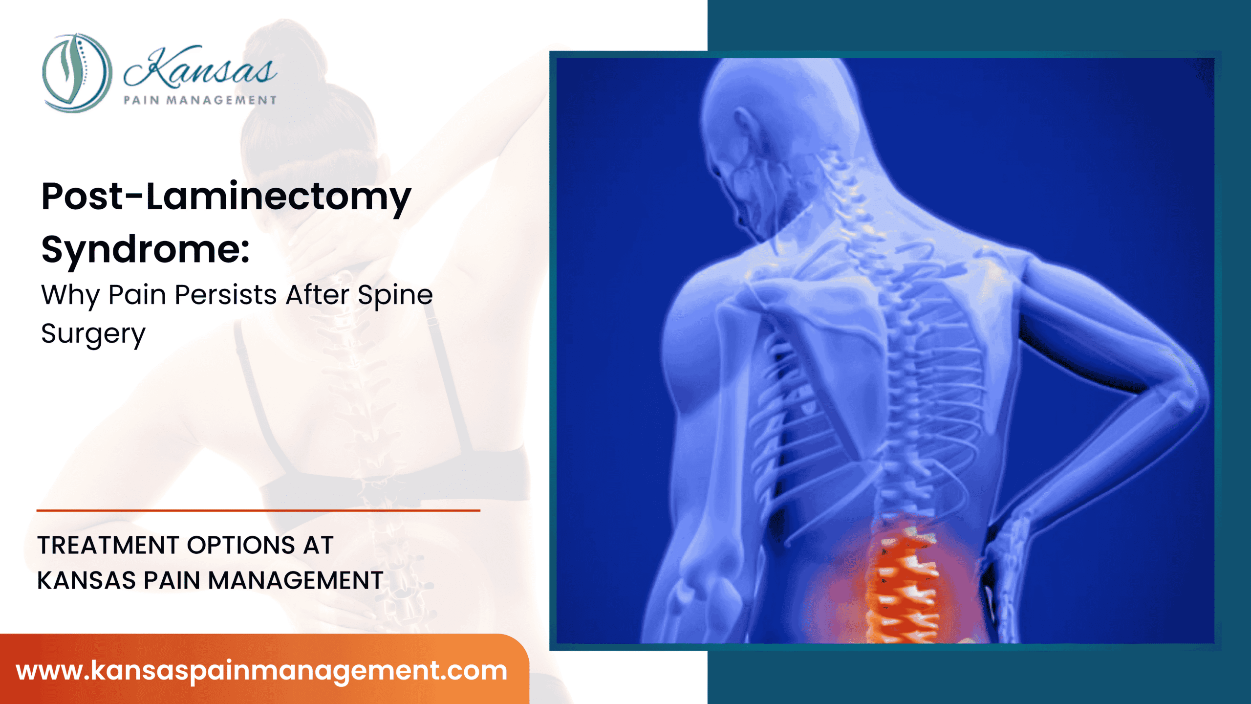 Post-Laminectomy-Syndrome-Why-Pain-Persists-After-Spine-Surgery-scaled