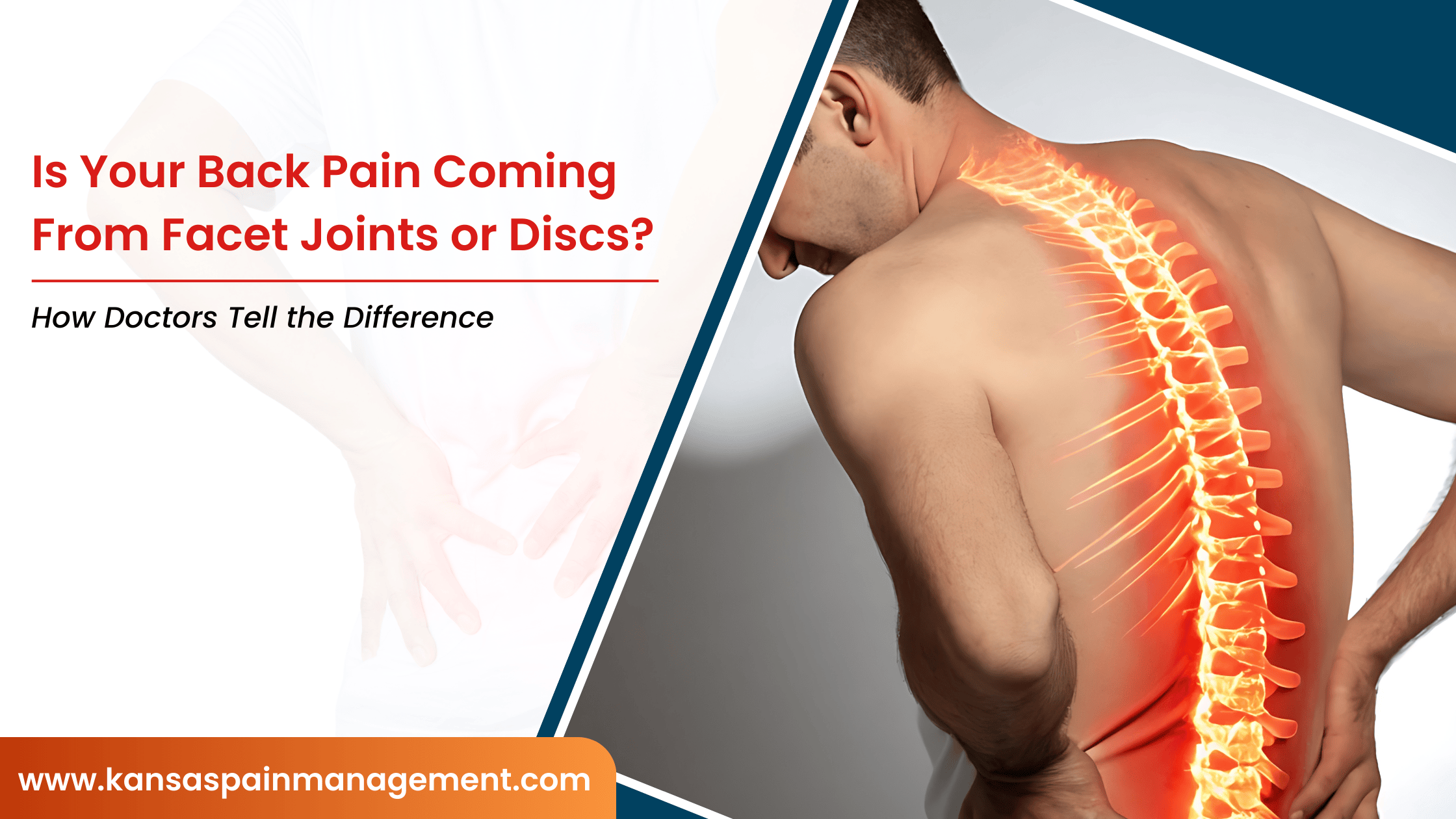 Is-Your-Back-Pain-Coming-From-Facet-Joints-or-Discs