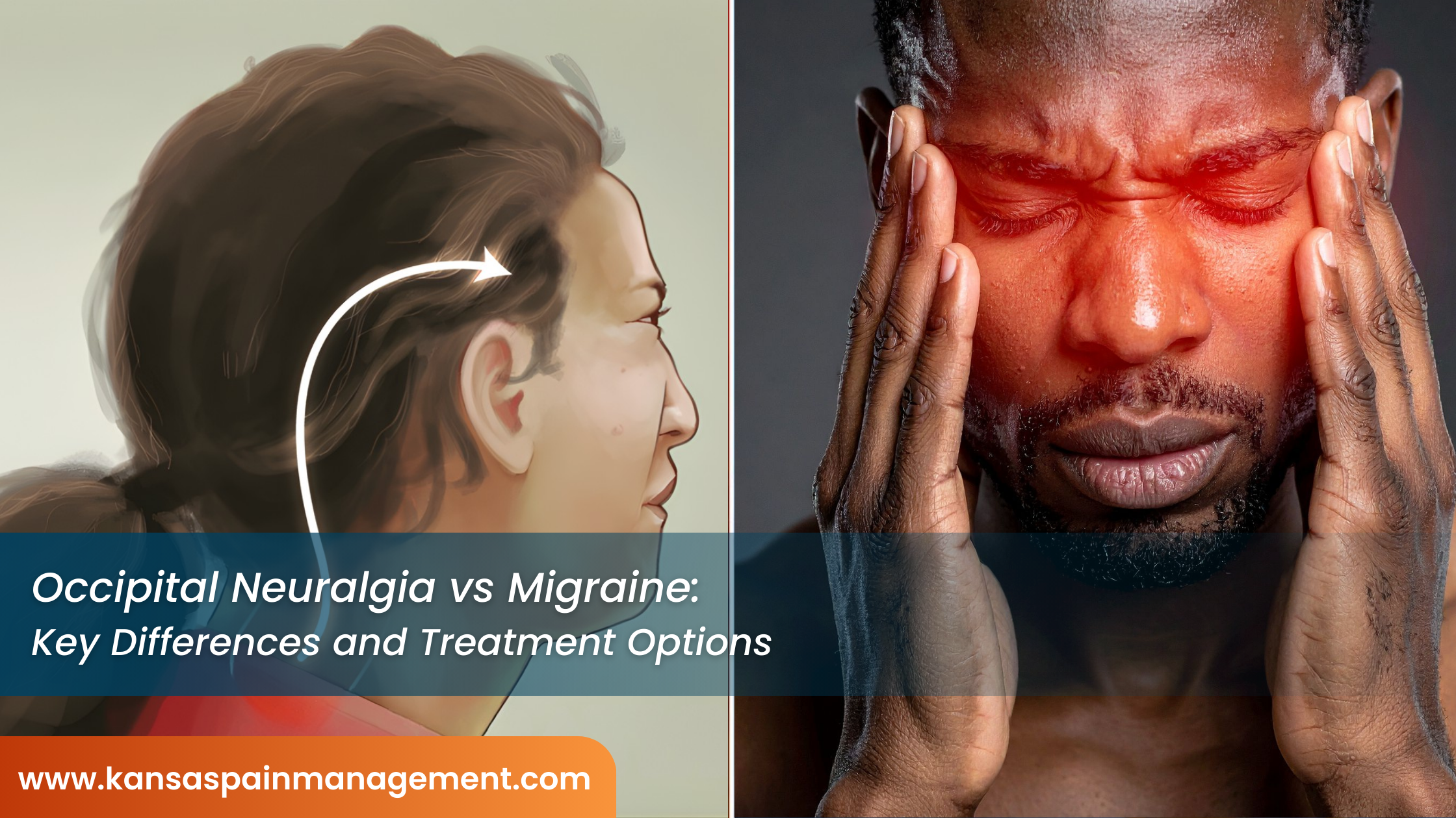 Occipital-Neuralgia-vs-Migraine-Key-Differences-and-Treatment-Options