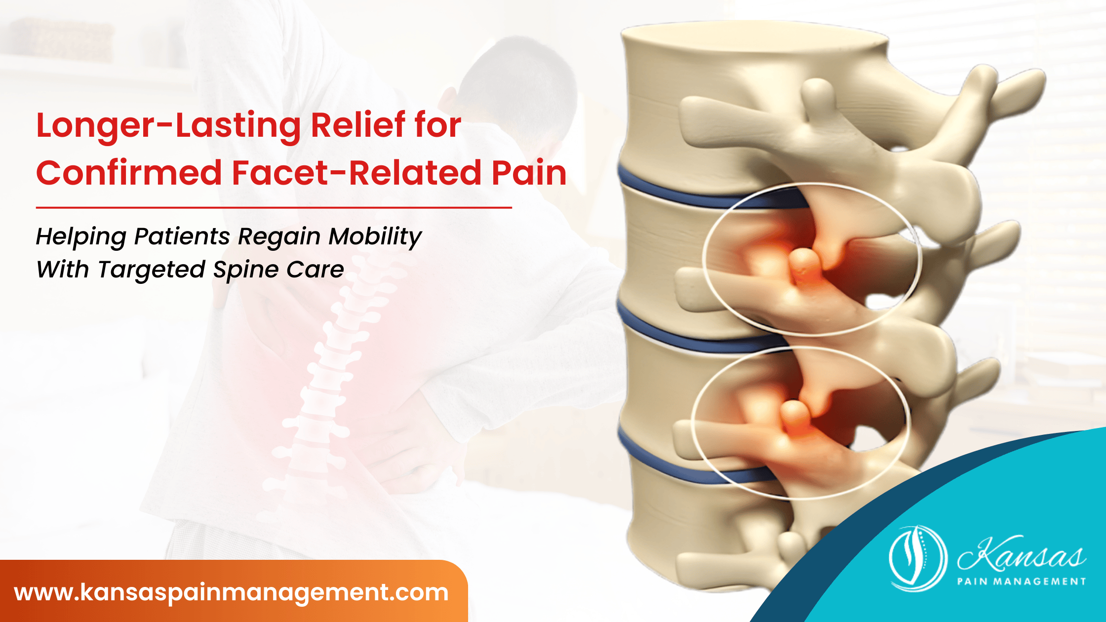 Longer-Lasting-Relief-for-Confirmed-Facet-Related-Pain