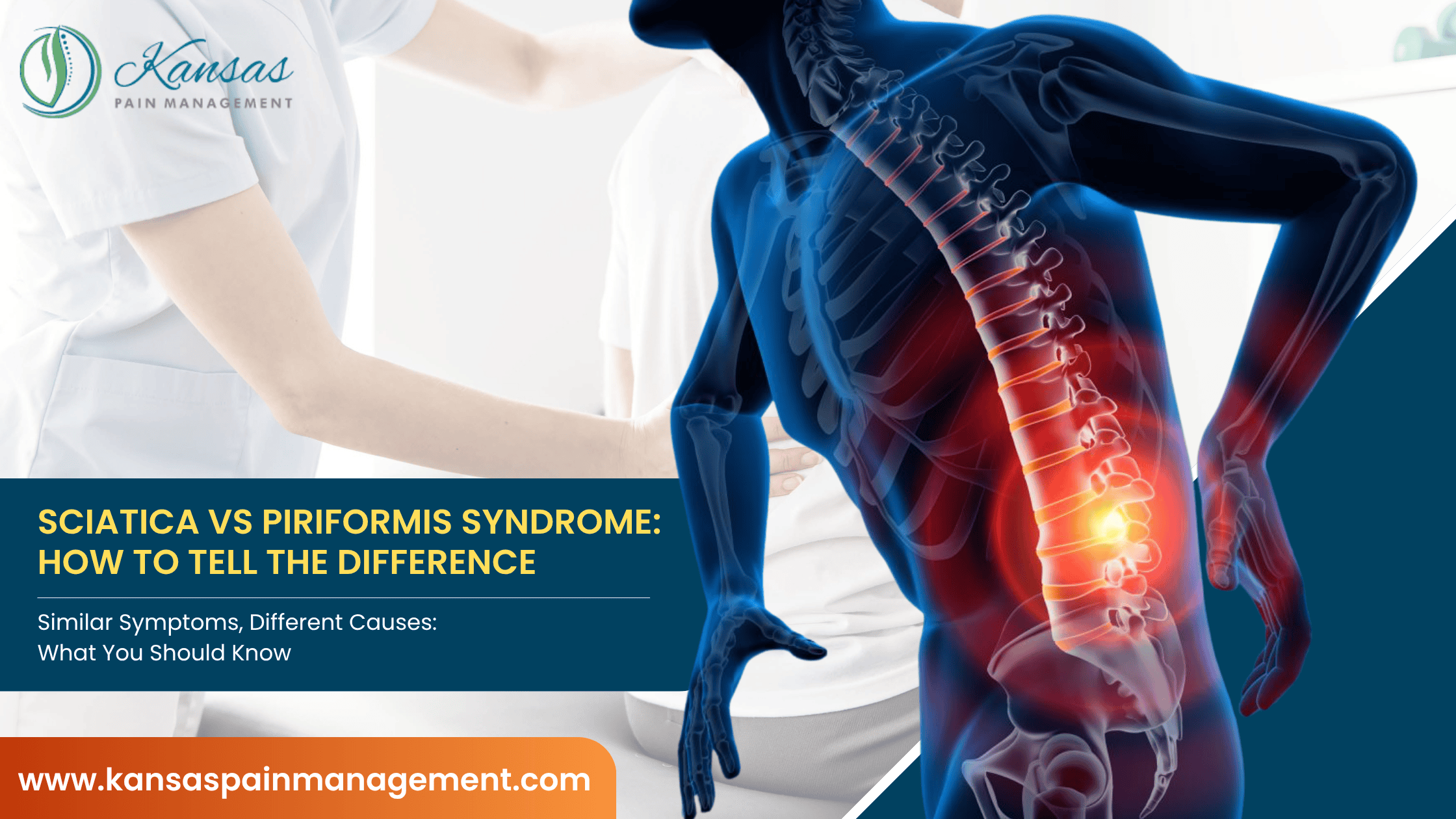 Sciatica-vs-Piriformis-Syndrome-How-to-Tell-the-Difference