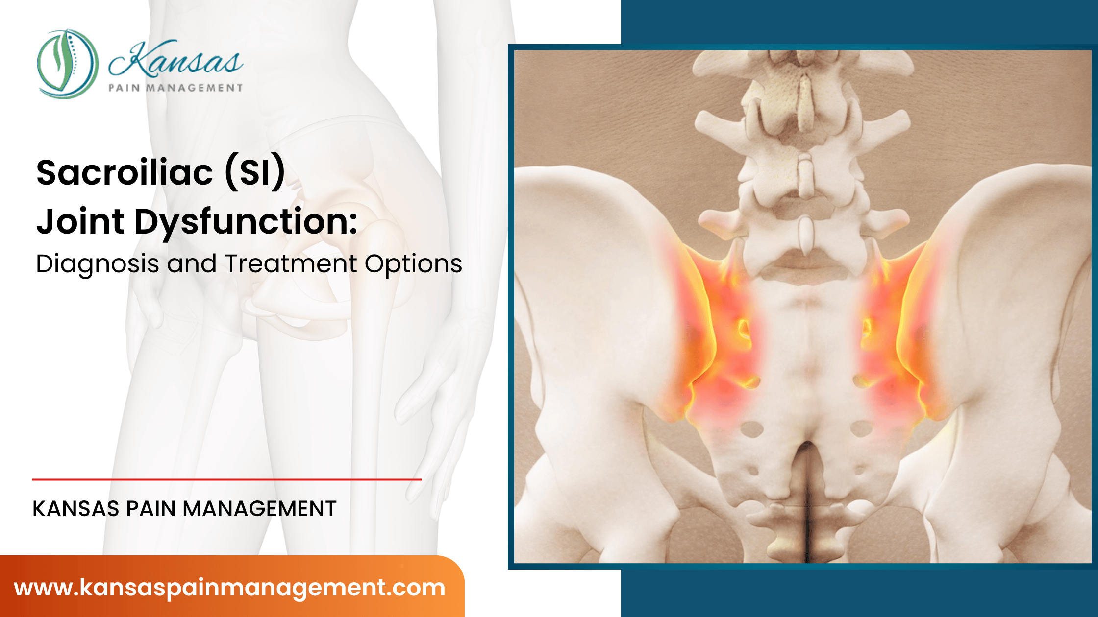 Sacroiliac-SI-Joint-Dysfunction-Diagnosis-and-Treatment-Options