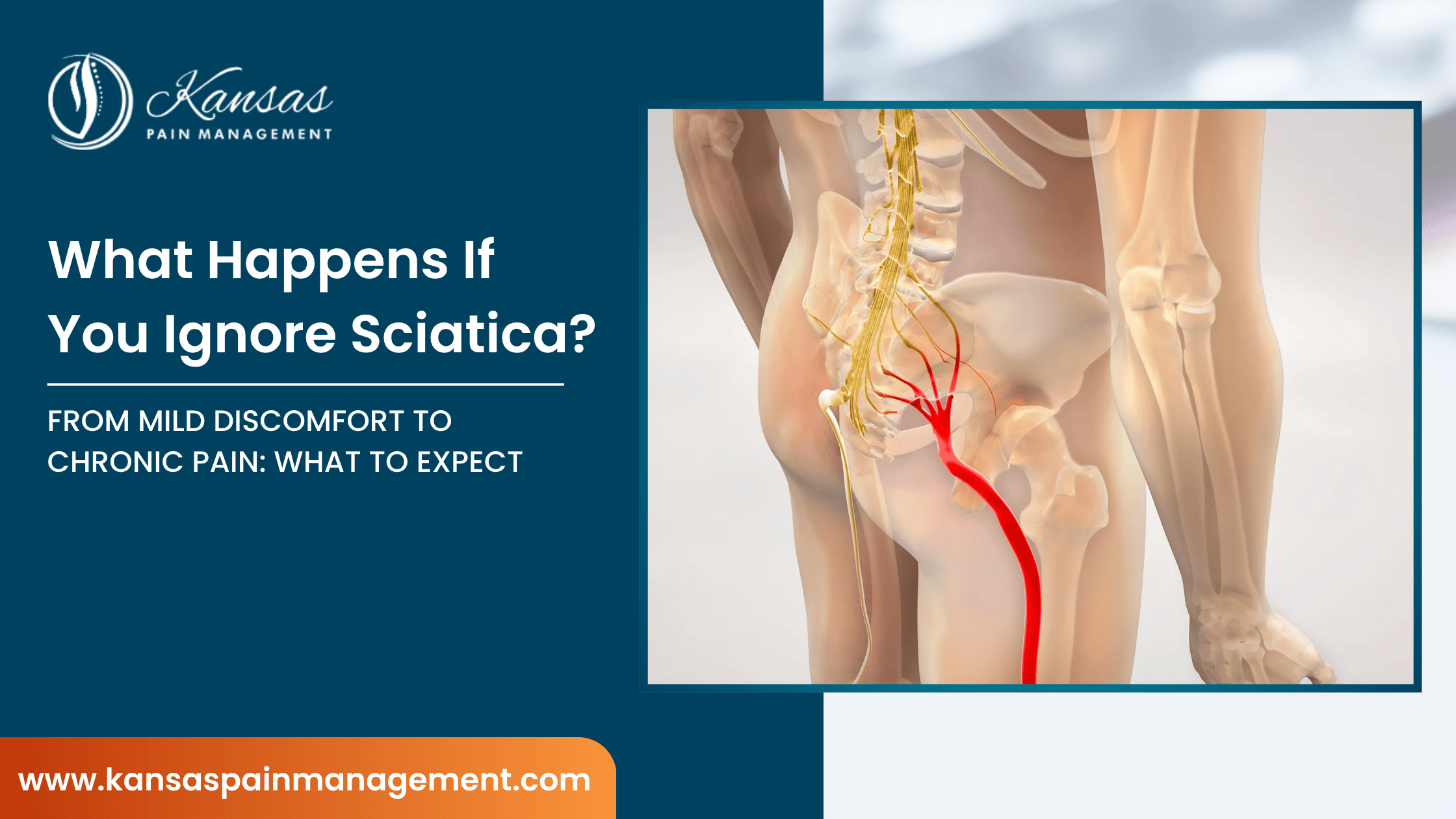 What-Happens-If-You-Ignore-Sciatica