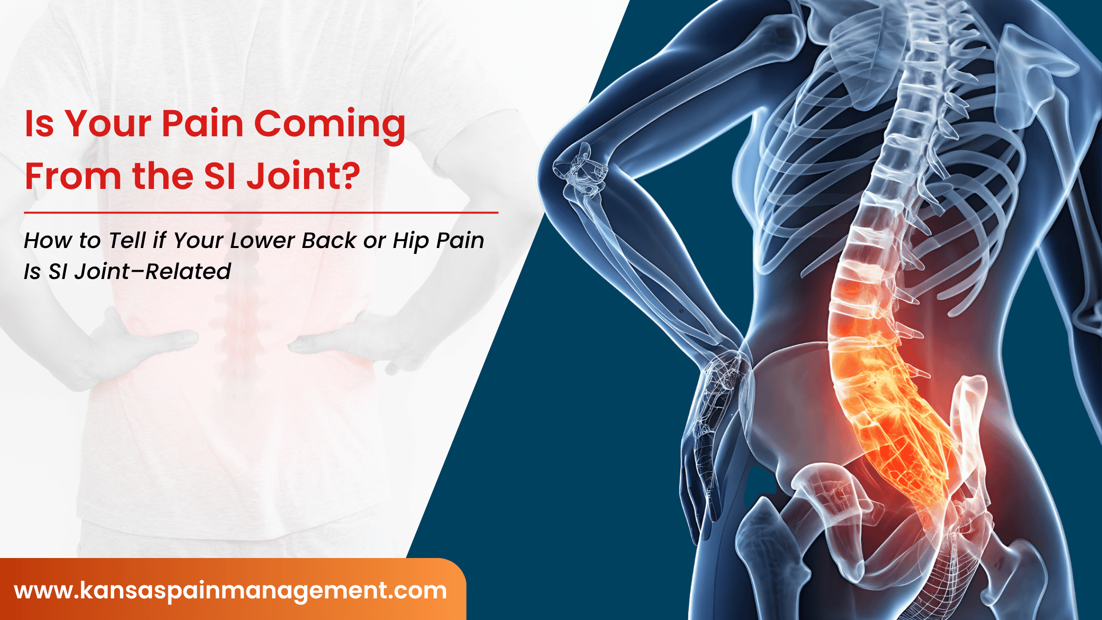 Is-Your-Pain-Coming-From-the-SI-Joint
