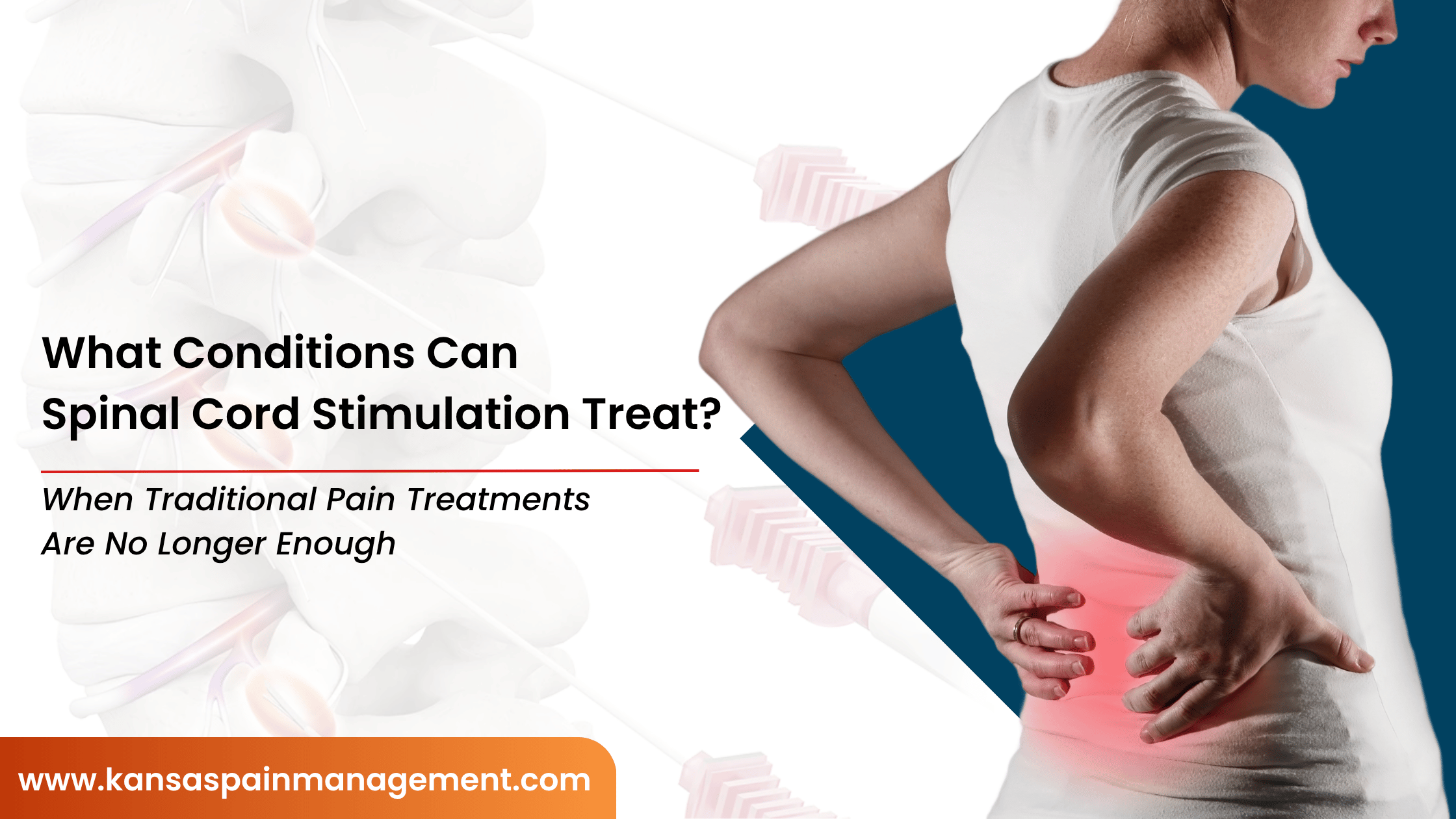 What-Conditions-Can-Spinal-Cord-Stimulation-Treat