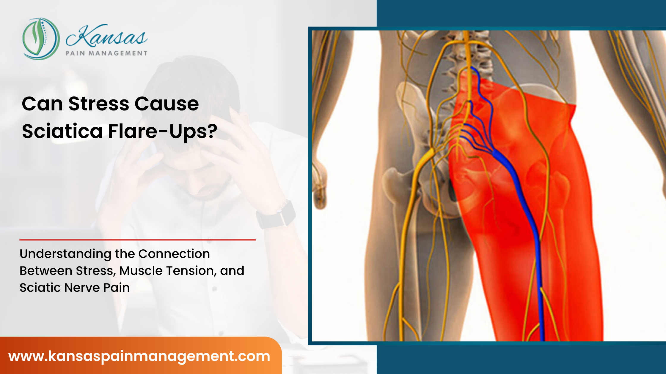 Can-Stress-Cause-Sciatica-Flare-Ups